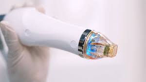 Secret RF Microneedling